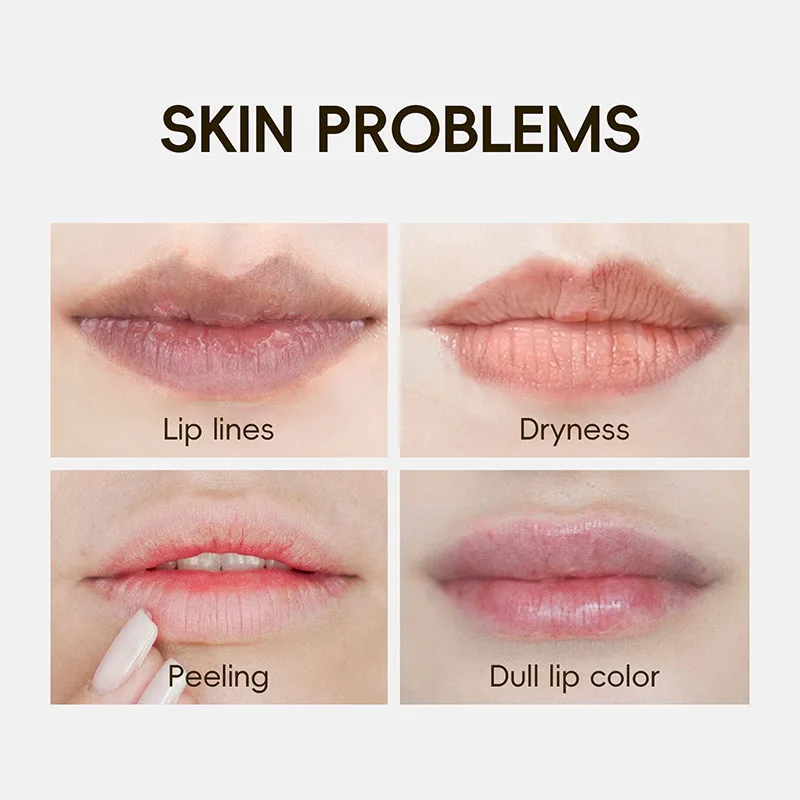 10pcs 24K Golden Crystal Collagen Lip Mask Moisturizing Plump Lips Gel Masks Nourishing Hydrating Lip Plumper Lips Skin Care - Image 6