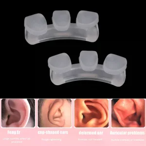 1/2Pcs Baby Auricle Support External Auricle Corrector Protruding Baby Ear Corrector Baby External Auricle Corrector Ear Pads