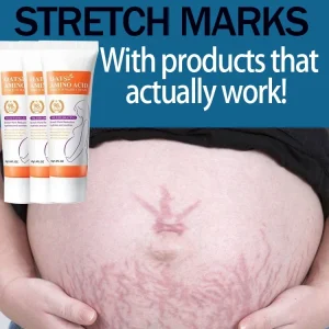 Stretch Marks Permanent Removal Cream Eliminate Body Belly Stretch Marks Swelling Marks Remove Skin Cracks Repair Firming Care