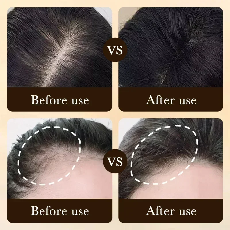 Biotin Fast Hair Growth Strengthening Hair Roots Care Scalp Massage Treatments Anti Hair Loss Effective Grow Thicker Hair Serum - Image 2