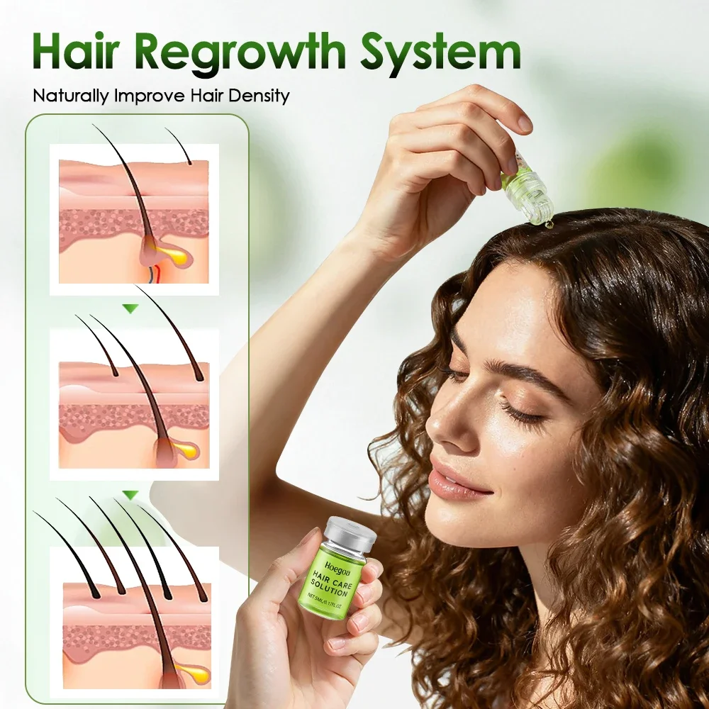 Hair Essential Care Serum Strengthen Roots Reducing Loss Prevent Baldness Nourish Scalp Hair Care Anti-Hair Loss Conditioner - Image 3