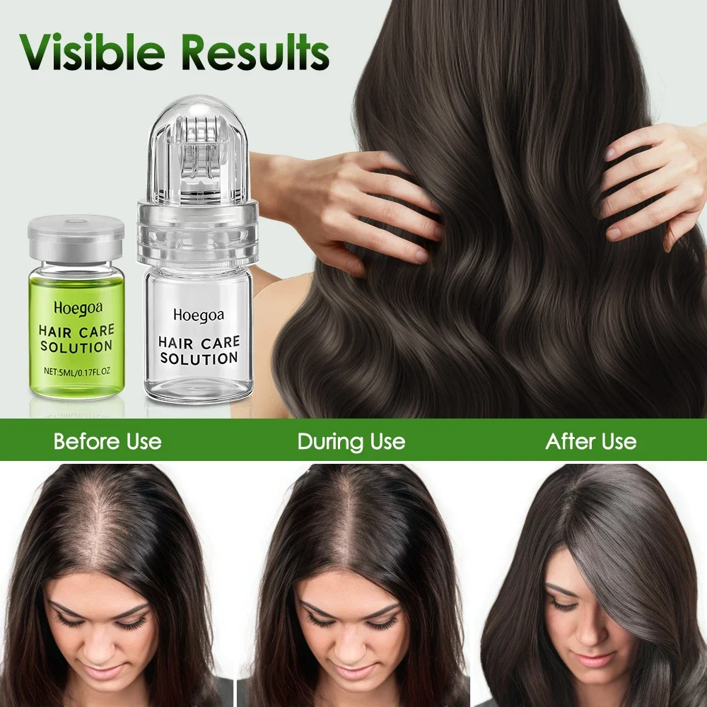 Hair Essential Care Serum Strengthen Roots Reducing Loss Prevent Baldness Nourish Scalp Hair Care Anti-Hair Loss Conditioner - Image 4