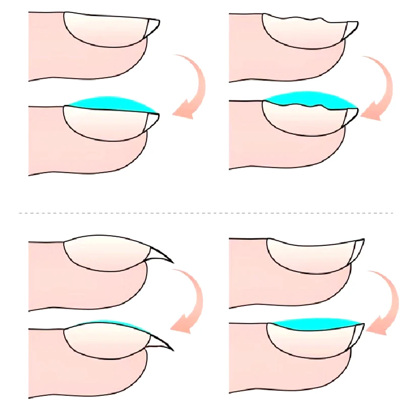 KODI JYJ Self-leveling Gel Nail Polish 12ml Semi-permanent Reinforcement Gellac Manicure Desgin Create uv Varnish Multifunction - Image 3