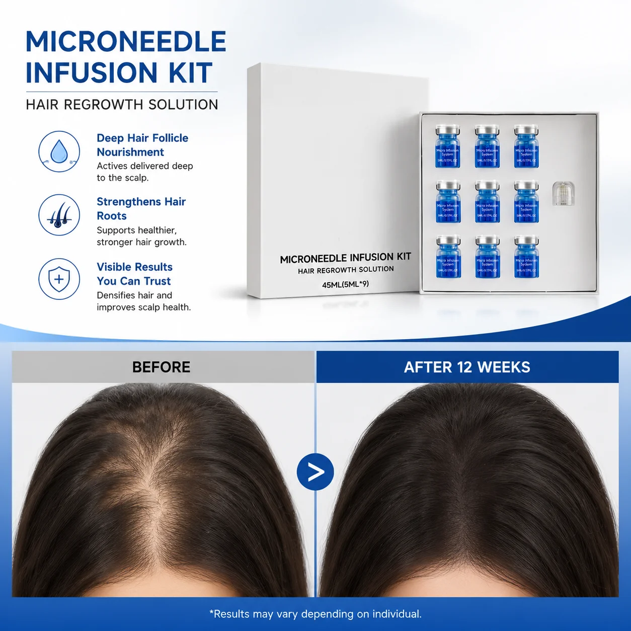 Microneedle Hair Regrowth Kit Solution Scalp Nourishing Serum For Hair Health Maintenance Needle Head Use Scalp Care Kit - Image 3