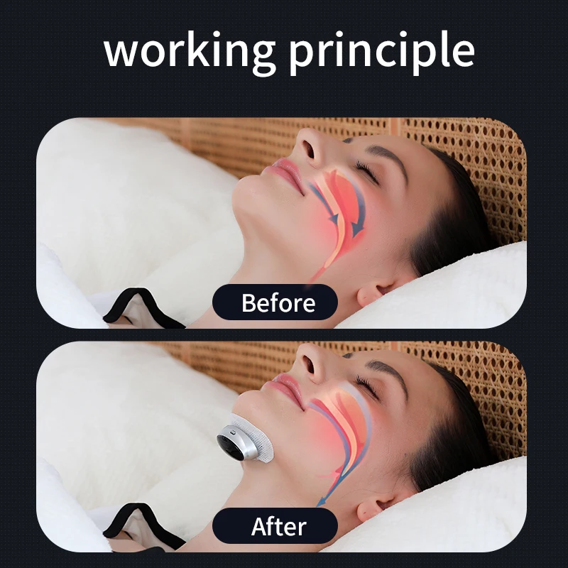Anti Snore Device - Dual-Pulse Stimulation Sleep Apnea Relief Snore Reduction Muscle Trainer Better Breath Health Care Tool - Image 4